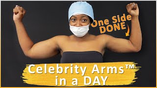 Arm Liposuction Immediate Results  Celebrity Arms™  Lipo 360 Arms  HighDefinition Expert Dr Su [upl. by Eahs649]