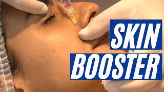 SKINBOOSTER [upl. by Brost]