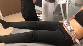 SculpSure Live Demo [upl. by Yromas]