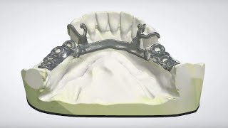 3Shape Dental System  RPD Design [upl. by Daveda]