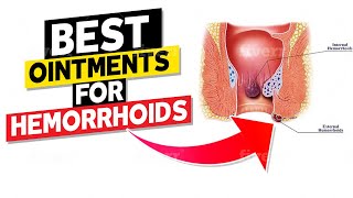 Best Ointments for Hemorrhoids [upl. by Aivila700]