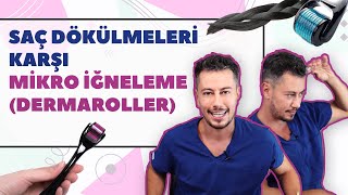 Saç Dökülmeleri Karşı Mikro İğneleme Dermaroller [upl. by Nodgnal420]