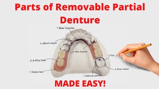 Parts of Removable Partial Denture Cast Partial Denture [upl. by Shirline326]